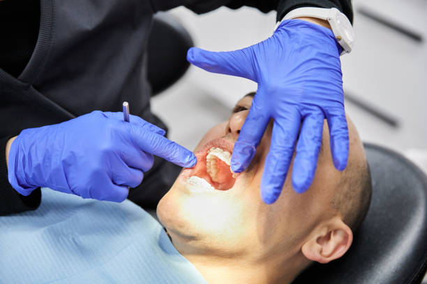 Best Emergency Dental Surgery in Rosharon, TX