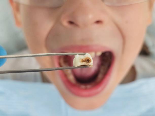 Best Walk-In Emergency Dentist in Rosharon, TX