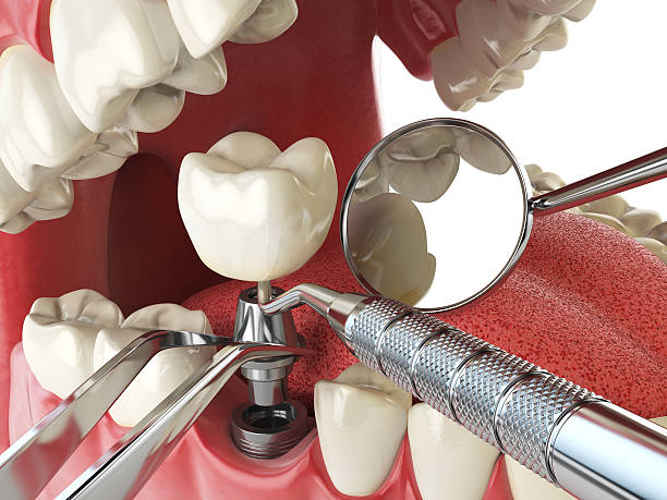 Best After-Hours Emergency Dentist in Rosharon, TX